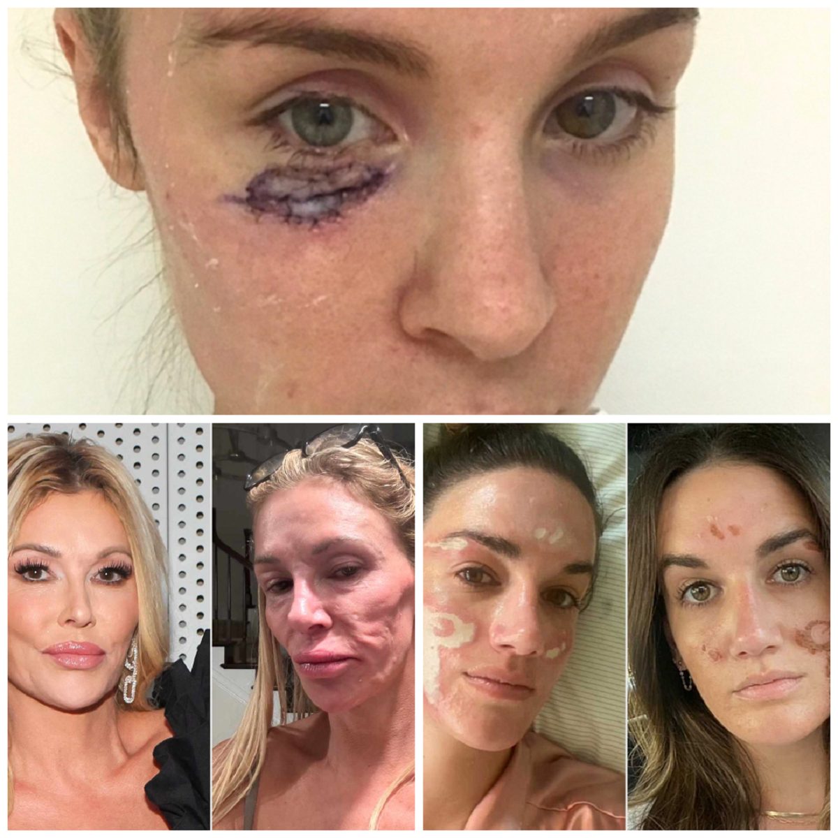 Woman claims celebrity facialist left her permanently scarred after $90K treatments